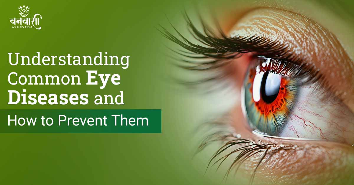 Common eye diseases